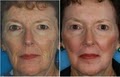 Cosmetic Laser Center Of Des Plaines image 3