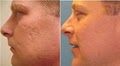 Cosmetic Laser Center Of Des Plaines image 1