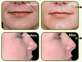 HD MedSpa & Clinic - Dermal Fillers & Anti Aging Chicago-Hormone Replacement image 3