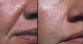 HD MedSpa & Clinic - Dermal Fillers & Anti Aging Chicago-Hormone Replacement image 6