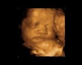 MedLife Imaging 3D 4D Ultrasound image 1