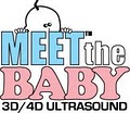 Meet the BABY Ultrasound logo