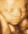 Stork Vision Prenatal Imaging Center image 3