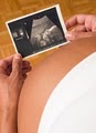 Stork Vision Prenatal Imaging Center logo