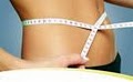Tampa Medical Weight Loss Clinic | Health Nutrition Wellness Center Tampa FL image 3
