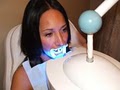 Teeth Whitening of Middleton image 2