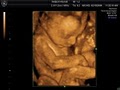 Ultracare 4D Baby Imaging image 2