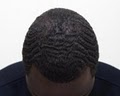 A Z Hair Restoration image 6