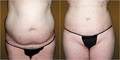 Avanti Skin & Laser Lipo Clinic of Fresno image 2