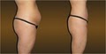 Avanti Skin & Laser Lipo Clinic of Fresno image 5
