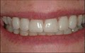 Bloomfield Hills MI Dentist: Edward A. Borio D.D.S. image 9