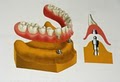 Dr Steven Crandall Cosmetic and Implant Dentistry image 2