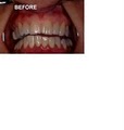 Dr Steven Crandall Cosmetic and Implant Dentistry image 3