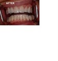 Dr Steven Crandall Cosmetic and Implant Dentistry image 4