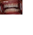 Dr Steven Crandall Cosmetic and Implant Dentistry image 4