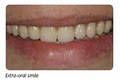 Dr Steven Crandall Cosmetic and Implant Dentistry image 1