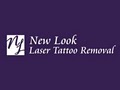 New Look Laser Tattoo Removal image 2