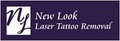 New Look Laser Tattoo Removal image 1