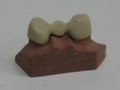 Newton Dental Lab, Inc. image 7