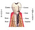 Phoenix Dental, Inc. - Ramon Bana, DDS image 1