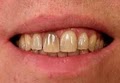 Seattle SmileWorks, Farad G. Bell, DDS, PLLC image 3