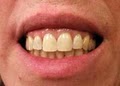 Seattle SmileWorks, Farad G. Bell, DDS, PLLC image 5