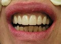 Seattle SmileWorks, Farad G. Bell, DDS, PLLC image 9