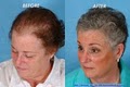 Bauman Medical Group - Hair Restoration for Men and Women image 4