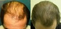 Jupiter Dermatology & Hair Restoration image 3