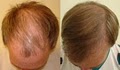 Jupiter Dermatology & Hair Restoration image 5