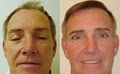 Jupiter Dermatology & Hair Restoration image 6