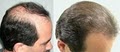 Jupiter Dermatology & Hair Restoration image 8