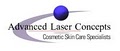Advanced Laser Concepts image 1