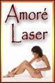 Amore Laser Hair Removal image 4
