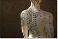 Eun Mi Hoffman Holistic Acupuncture & Herbs image 6