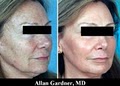 Gardner Dermatology: Gardner Alan M MD image 7