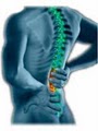Intelligent Balance Spinal Care & Wellness Center, PLLC image 10