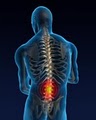 Lauterbach Chiropractic & Acupuncture image 1
