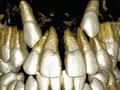 Phoenix, AZ Orthodontics - Dr. Clark L. Jones image 2