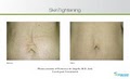 Renew Cosmetic Spa Laser Hair Removal St Louis image 9