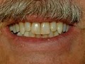 Robert B. Wolf, DDS, PA image 5
