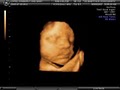 3d Babyface Sonography image 2