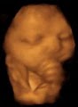 3d Babyface Sonography image 5