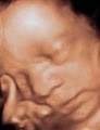 3d Babyface Sonography image 6