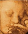 3d Babyface Sonography image 8