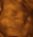 3d Babyface Sonography image 10