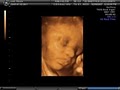 3d Babyface Sonography image 1
