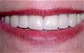 Austin Dentist | Southpark Smiles image 2
