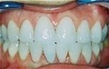 Austin Dentist | Southpark Smiles image 3
