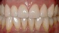 Hawaii Pacific Dental Group - Dr. Rohinton J. Patel image 3